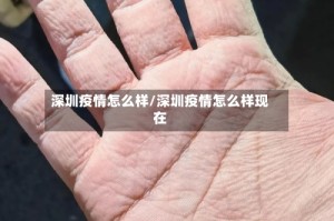 深圳疫情怎么样/深圳疫情怎么样现在