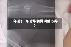 一年后(一年后取髌骨钢丝心得)