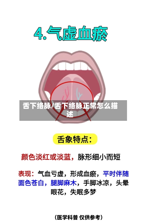 舌下络脉/舌下络脉正常怎么描述-第2张图片