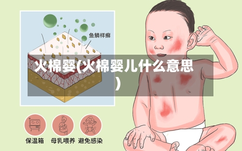 火棉婴(火棉婴儿什么意思)-第1张图片