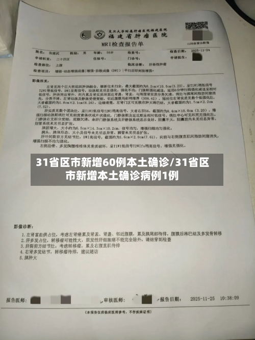 31省区市新增60例本土确诊/31省区市新增本土确诊病例1例-第3张图片