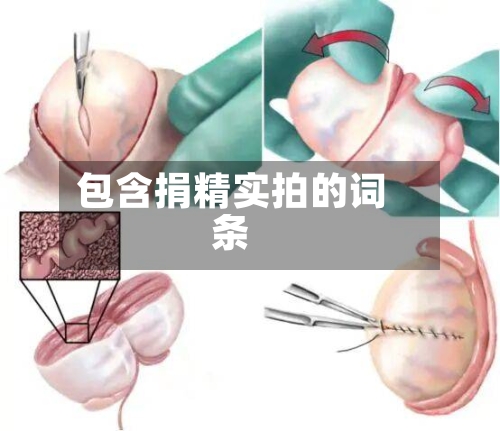 包含捐精实拍的词条-第3张图片